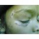 Arogyam pure herbs kit for vitiligo