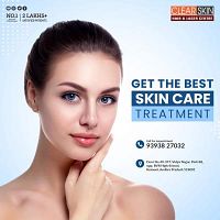 Best Skin Laser treatment in Andhra Pradesh AP