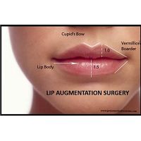 Enhance the Beauty with Lip Augmentation Surgery in Delhi